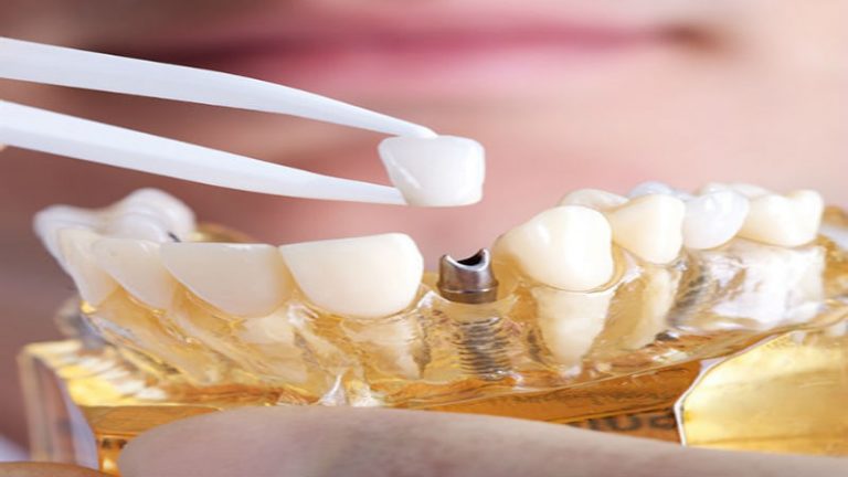 Problems Pediatric Dentistry can Solve in Cabot AR