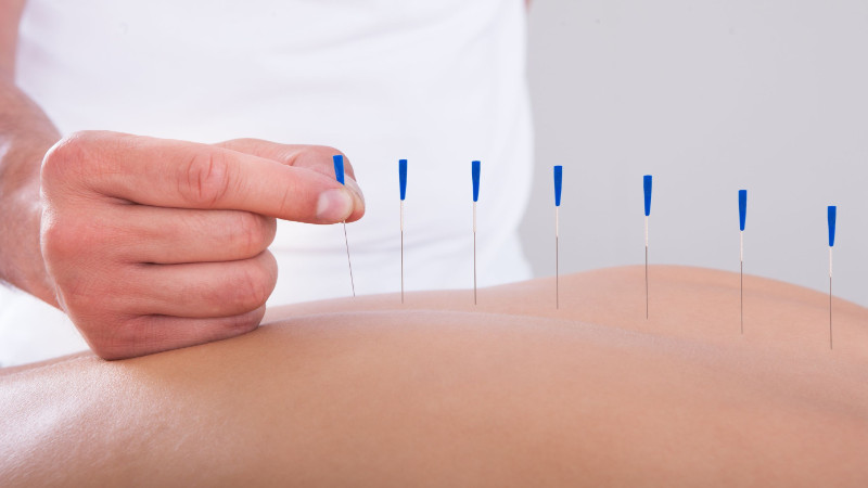 Benefits of Acupuncture For Depression in Kailua Kona HI