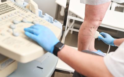 Comprehensive Guide To Vein Treatment In New York: Restore Your Leg Health