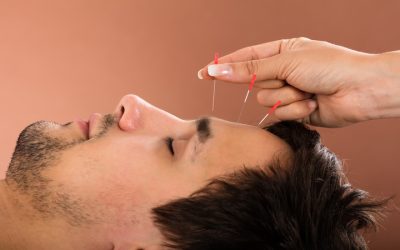 Natural Relief Options with Acupuncture For Pain Bellingham WA Residents Can Trust